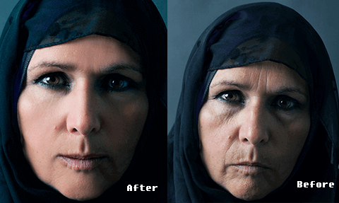 Before & After Photos of Goji Cream