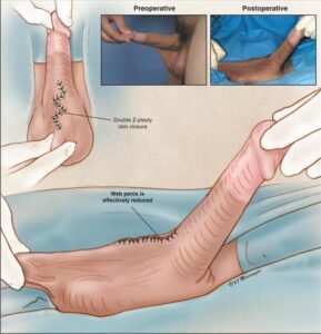 How To Increase Pennis Size In Hindi