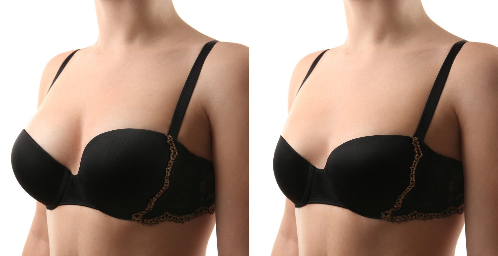 Breast Size Badhane Ki Cream | स्तन बड़ा करने की क्रीम