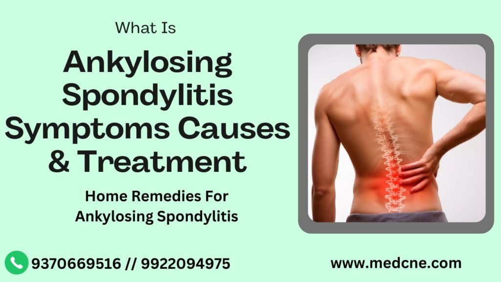 Ankylosing Spondylitis Symptoms Causes & Treatment