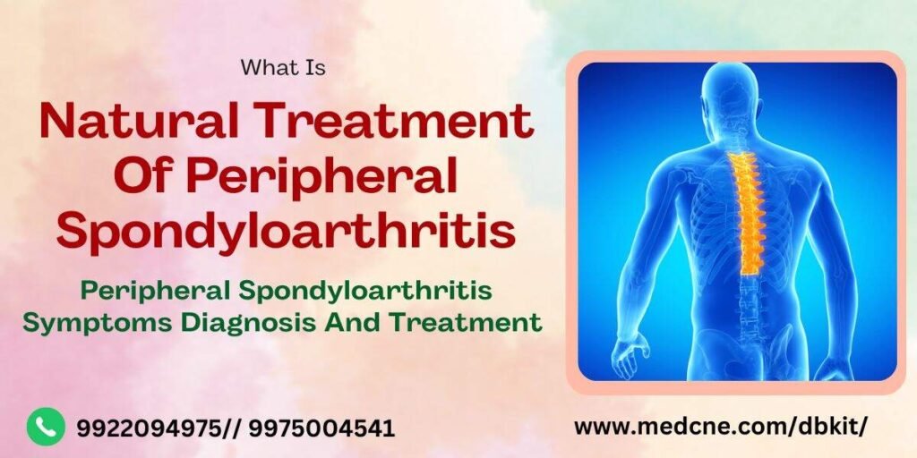 Natural Treatment Of Peripheral Spondyloarthritis